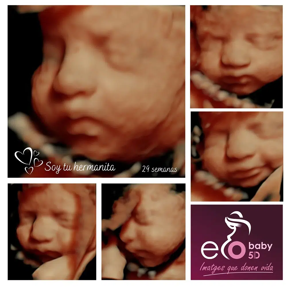 Ecografía 5D Barcelona Collage